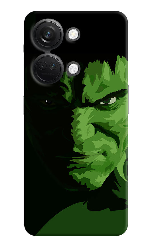 HULK OnePlus Nord 3 5G Hard Case Back Cover by Casekaro