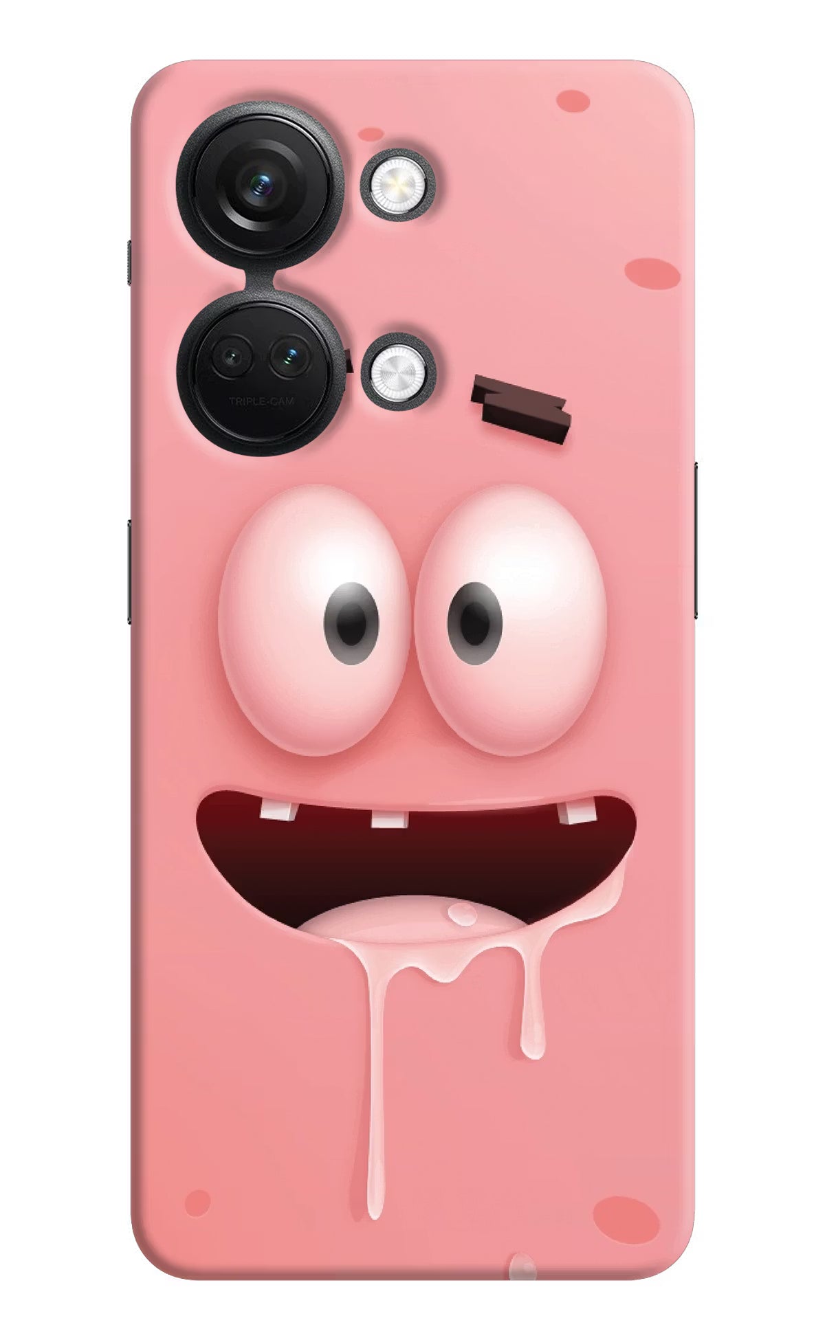 Sponge 2 OnePlus Nord 3 5G Hard Case Back Cover by Casekaro