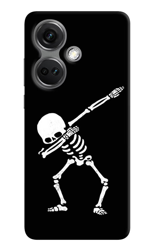 Dabbing Skeleton Art OnePlus Nord CE 3 5G Hard Case Back Cover by Casekaro