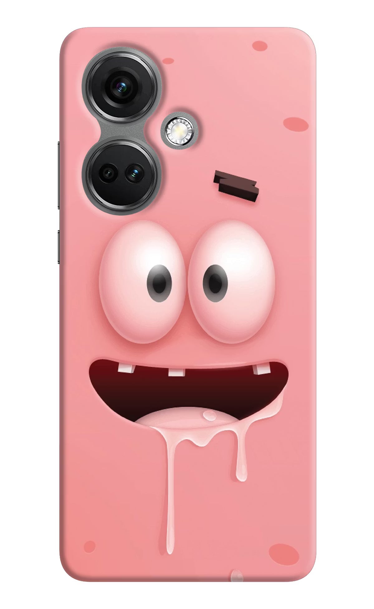 Sponge 2 OnePlus Nord CE 3 5G Hard Case Back Cover by Casekaro