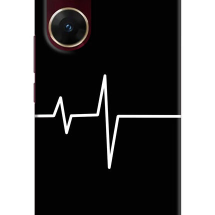 Heart Beats Vivo V29E Hard Case Back Cover by Casekaro
