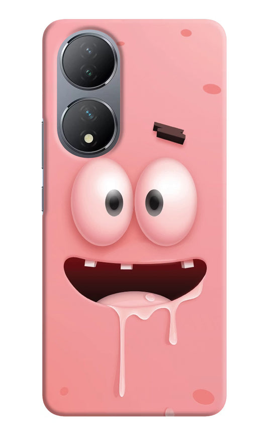 Sponge 2 Vivo Y100 Hard Case Back Cover by Casekaro