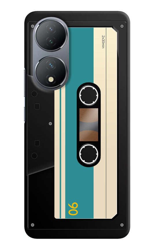 Cassette Vivo Y100 Hard Case Back Cover by Casekaro