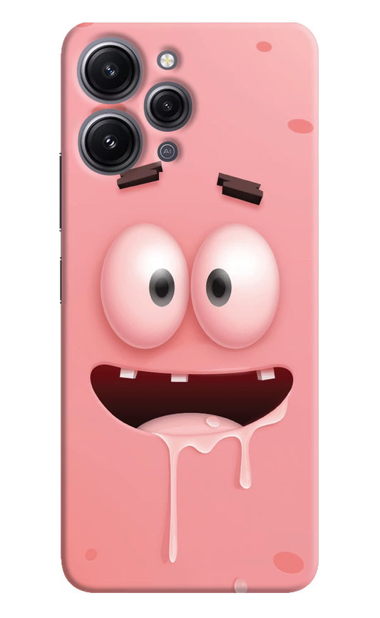 Sponge 2 Redmi 12 4G Hard Case Back Cover by Casekaro