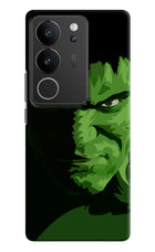HULK Vivo V29/V29 Pro Hard Case Back Cover by Casekaro