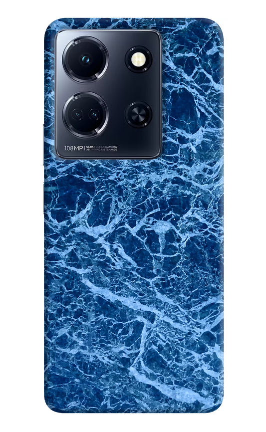 Blue Marble Infinix Note 30 5g Hard Case Back Cover by Casekaro