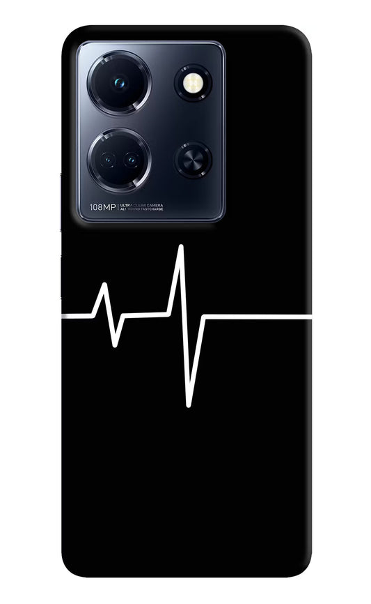 Heart Beats Infinix Note 30 5g Hard Case Back Cover by Casekaro