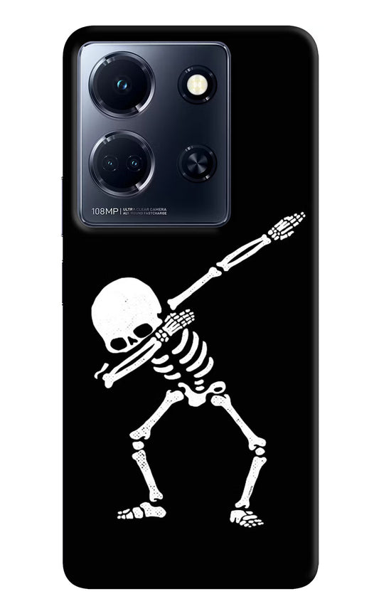 Dabbing Skeleton Art Infinix Note 30 5g Hard Case Back Cover by Casekaro