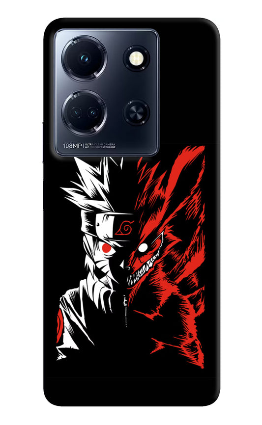 Naruto Two Face Infinix Note 30 5g Hard Case Back Cover by Casekaro