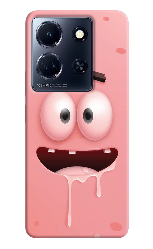 Sponge 2 Infinix Note 30 5g Hard Case Back Cover by Casekaro