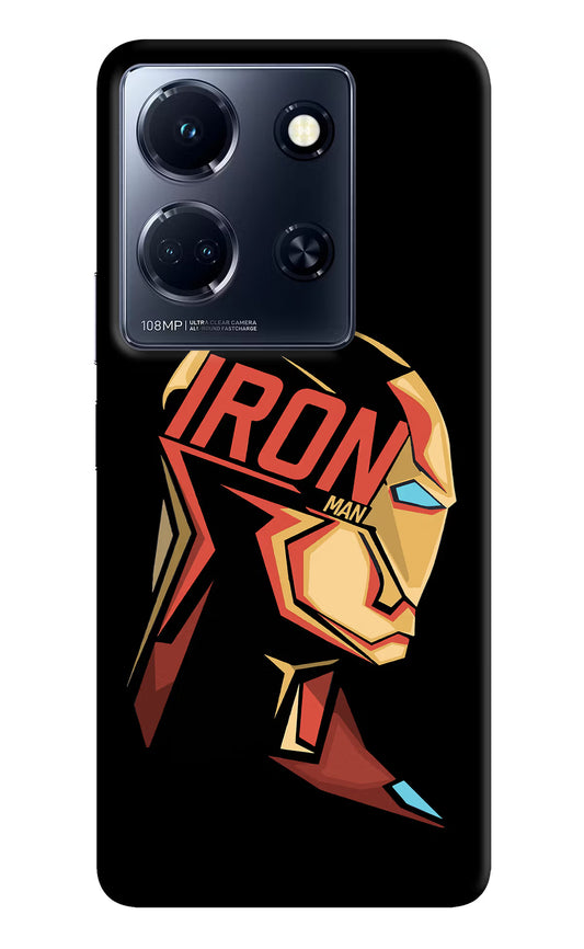 IronMan Infinix Note 30 5g Hard Case Back Cover by Casekaro