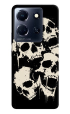 Dead Stack Infinix Note 30 5g Hard Case Back Cover by Casekaro