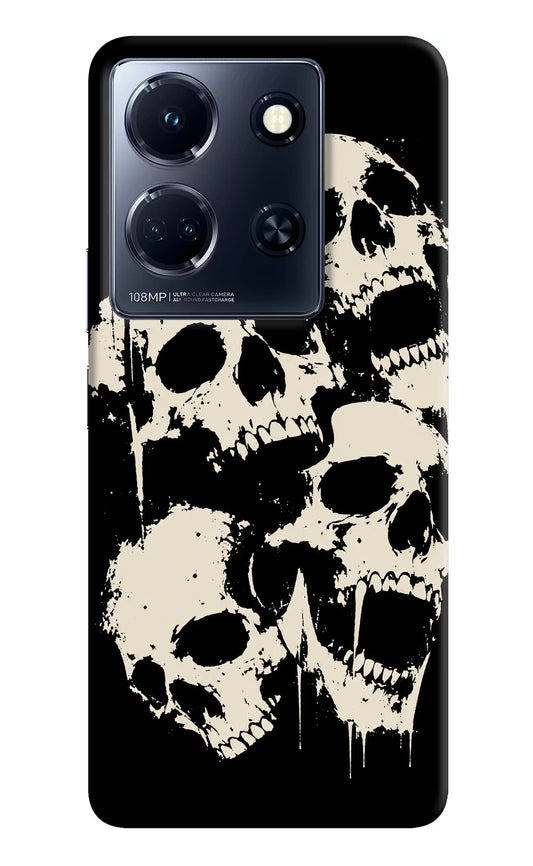 Dead Stack Infinix Note 30 5g Hard Case Back Cover by Casekaro
