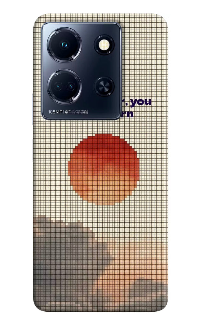 Pixel Sun Infinix Note 30 5g Hard Case Back Cover by Casekaro