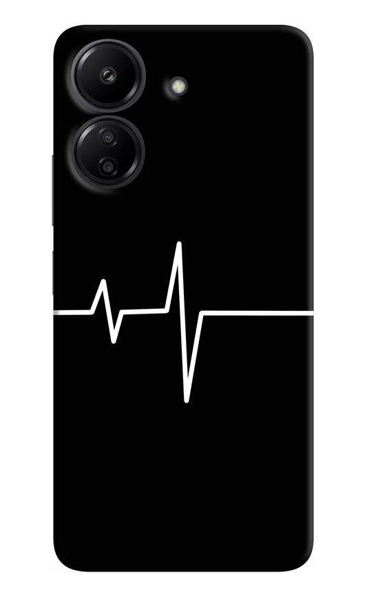 Heart Beats Redmi 13C 4G Hard Case Back Cover by Casekaro