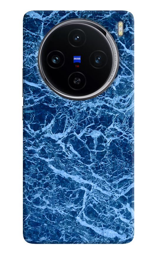 Blue Marble Vivo X100 Hard Case Back Cover by Casekaro