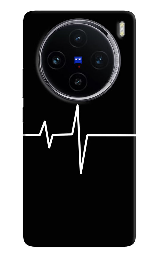 Heart Beats Vivo X100 Hard Case Back Cover by Casekaro