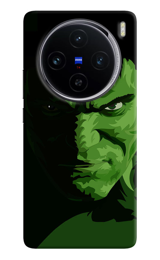 HULK Vivo X100 Hard Case Back Cover by Casekaro