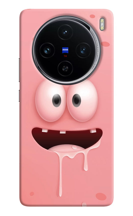Sponge 2 Vivo X100 Hard Case Back Cover by Casekaro