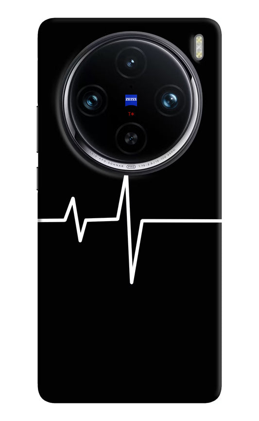 Heart Beats Vivo X100 Pro Hard Case Back Cover by Casekaro