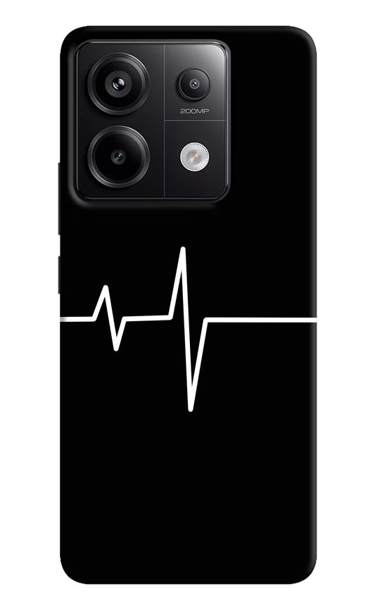 Heart Beats Redmi Note 13 Pro 5G Hard Case Back Cover by Casekaro