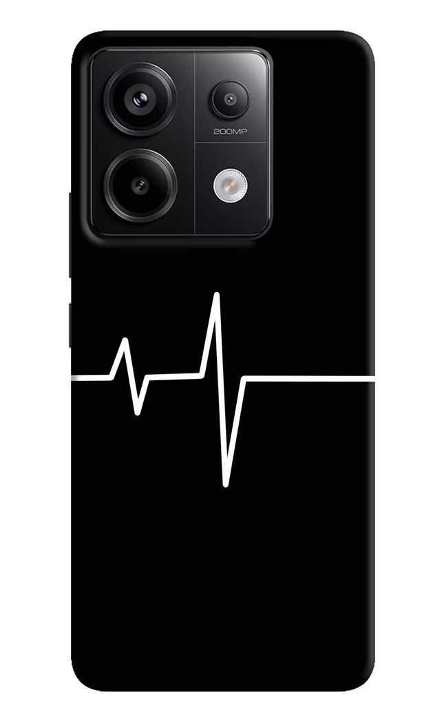Heart Beats Redmi Note 13 Pro 5G Hard Case Back Cover by Casekaro