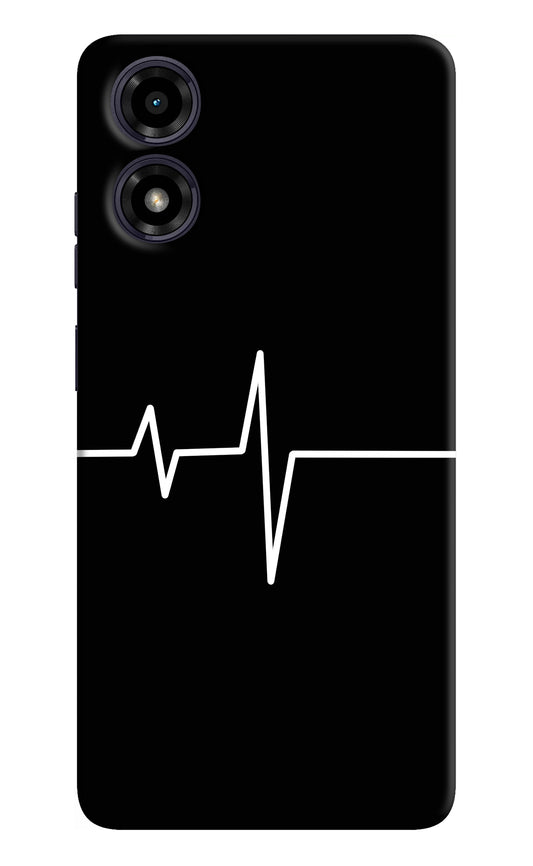Heart Beats Moto G04 Back Cover