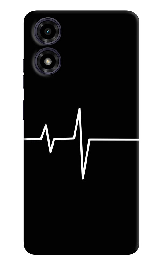 Heart Beats Moto G04 Hard Case Back Cover by Casekaro