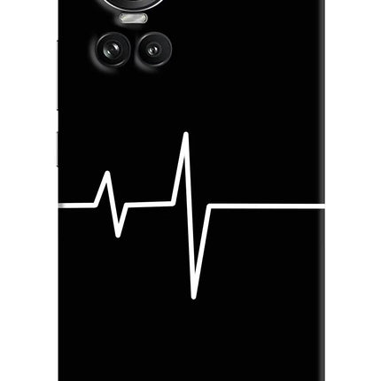 Heart Beats Oppo Reno10 5G/10 Pro 5G Hard Case Back Cover by Casekaro