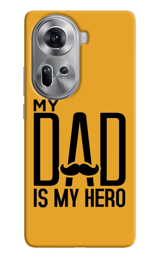 My Dad Is My Hero Oppo Reno11 Hard Case Back Cover by Casekaro