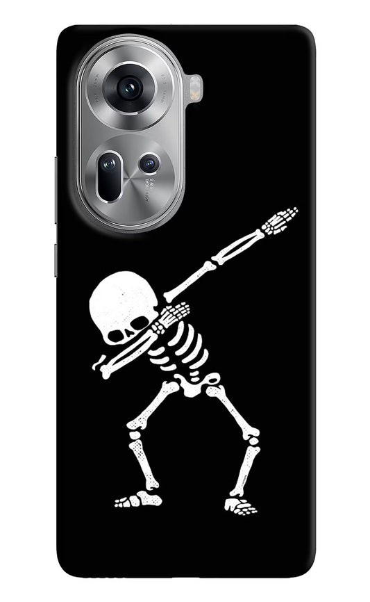 Dabbing Skeleton Art Oppo Reno11 Hard Case Back Cover by Casekaro