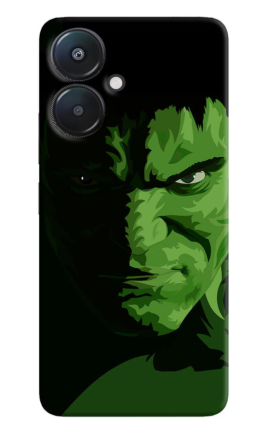 HULK Redmi 13C 5G Hard Case Back Cover by Casekaro