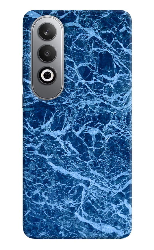Blue Marble Oneplus Nord CE4 Hard Case Back Cover by Casekaro
