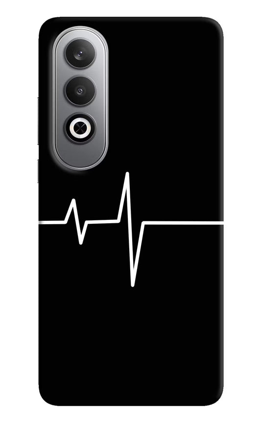 Heart Beats Oneplus Nord CE4 Hard Case Back Cover by Casekaro