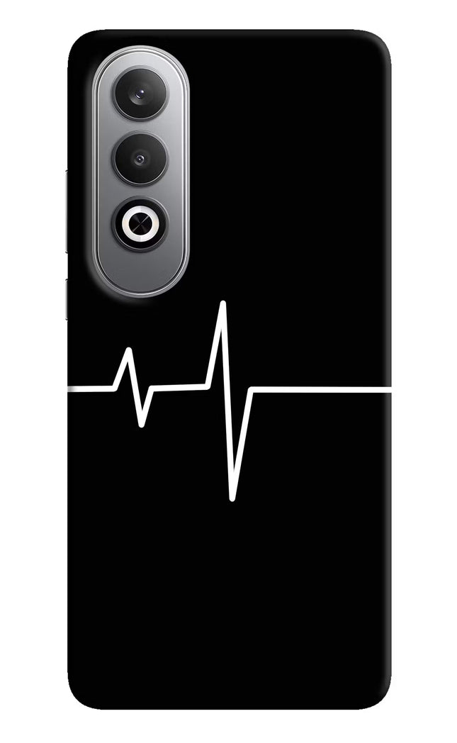 Heart Beats Oneplus Nord CE4 Hard Case Back Cover by Casekaro