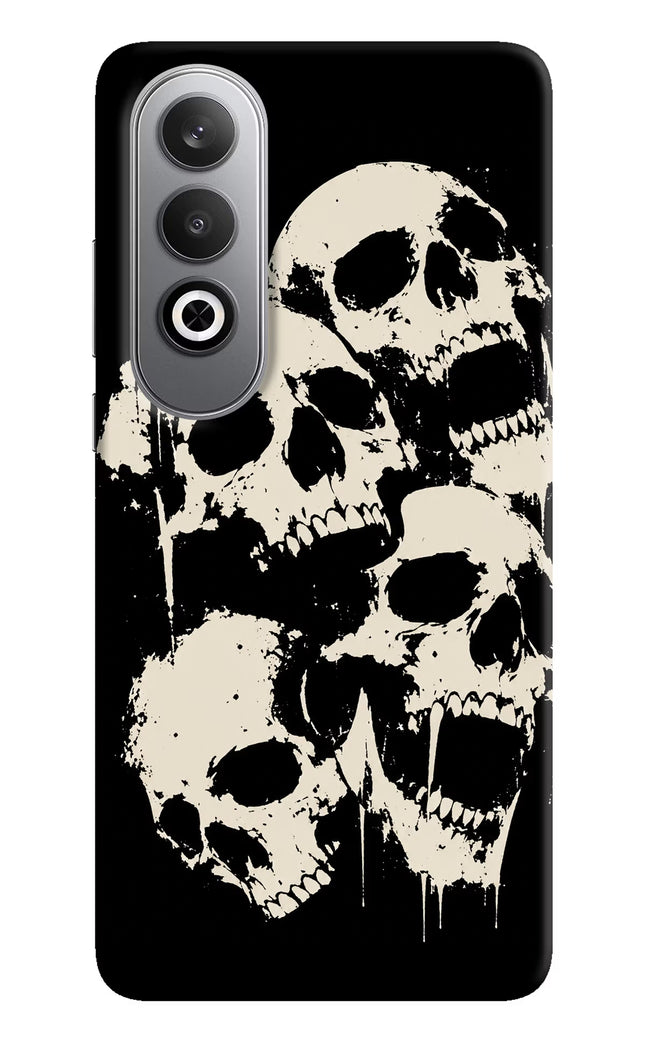 Dead Stack Oneplus Nord CE4 Hard Case Back Cover by Casekaro