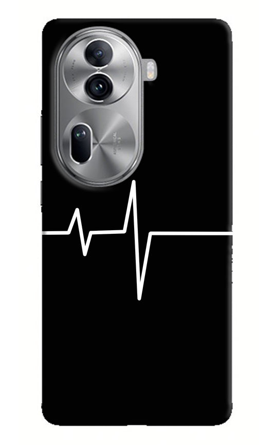 Heart Beats Oppo Reno11 Pro 5G Back Cover