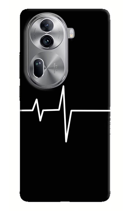 Heart Beats Oppo Reno11 Pro 5G Hard Case Back Cover by Casekaro