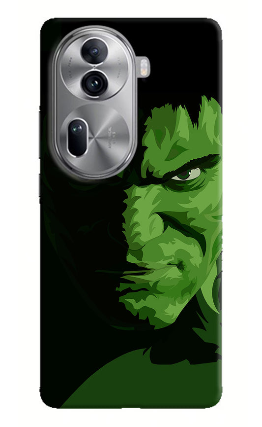 HULK Oppo Reno11 Pro 5G Hard Case Back Cover by Casekaro