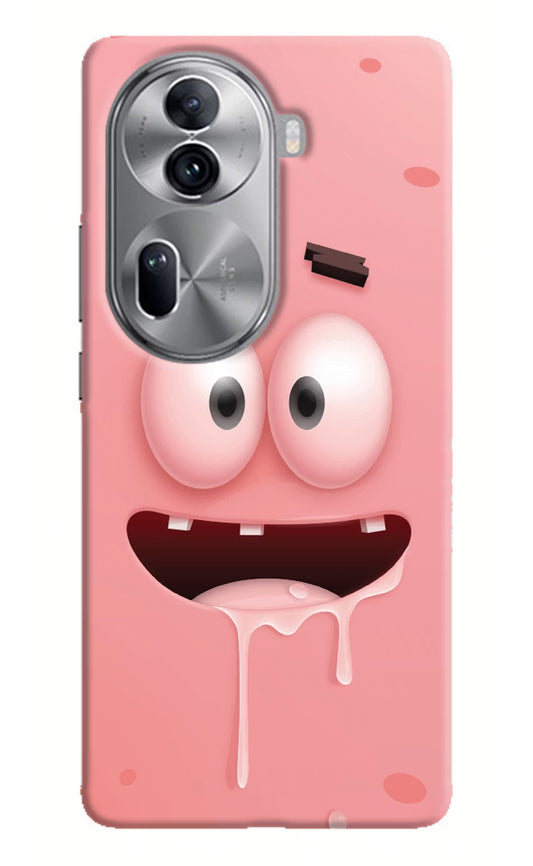 Sponge 2 Oppo Reno11 Pro 5G Hard Case Back Cover by Casekaro