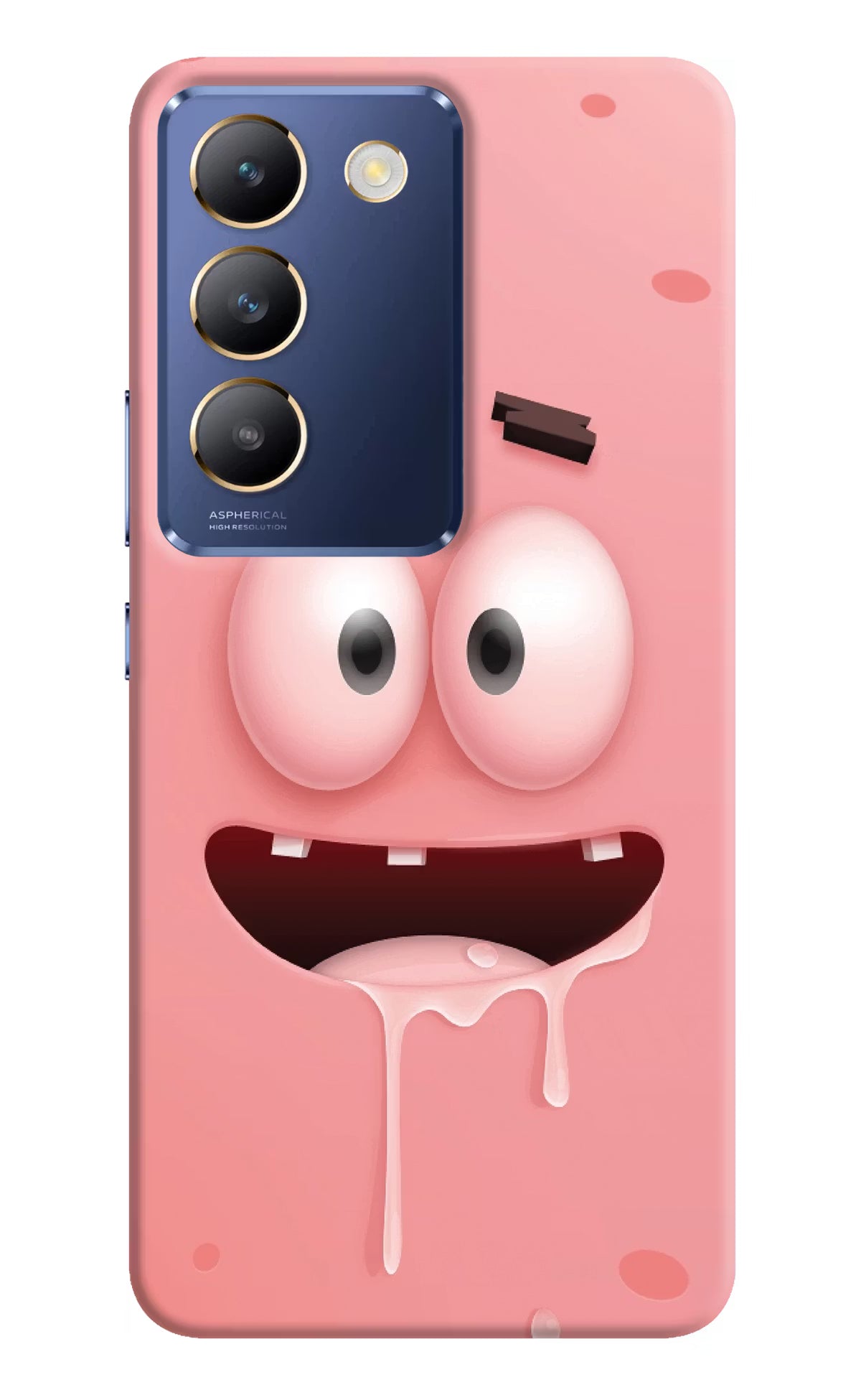 Sponge 2 Vivo Y200E 5G/T3 5G Hard Case Back Cover by Casekaro