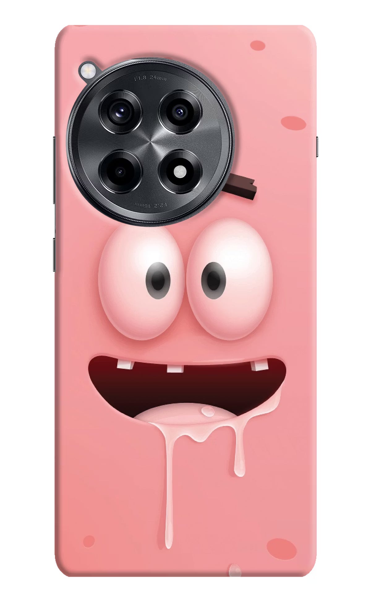 Sponge 2 OnePlus 12R Hard Case Back Cover by Casekaro