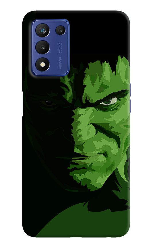 HULK Realme Narzo 30 Pro 5G Back Cover