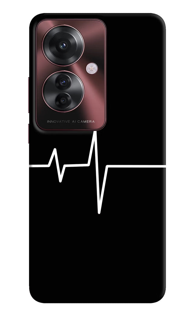 Heart Beats Oppo F25 Pro 5G Hard Case Back Cover by Casekaro