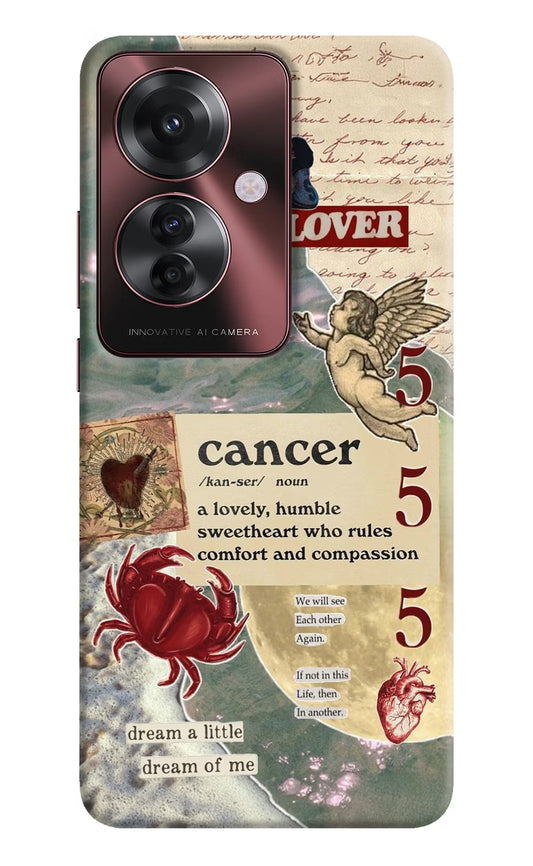 Cancer Zodiac Oppo F25 Pro 5G Hard Case Back Cover by Casekaro