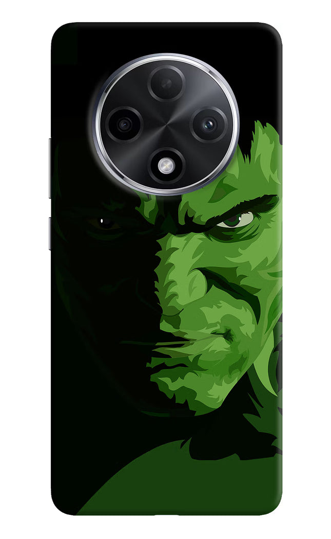 HULK Oppo F27 Pro Plus Hard Case Back Cover by Casekaro