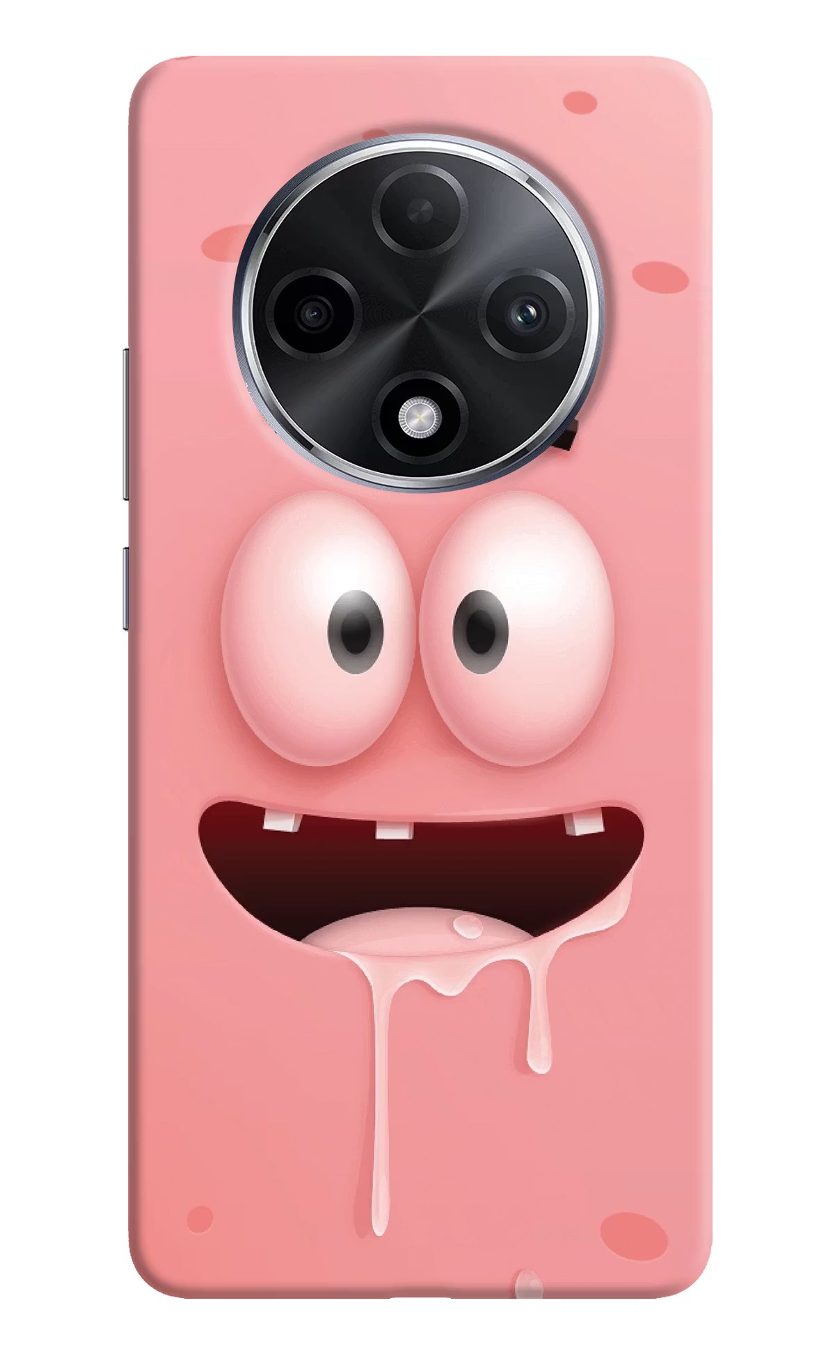 Sponge 2 Oppo F27 Pro Plus Hard Case Back Cover by Casekaro