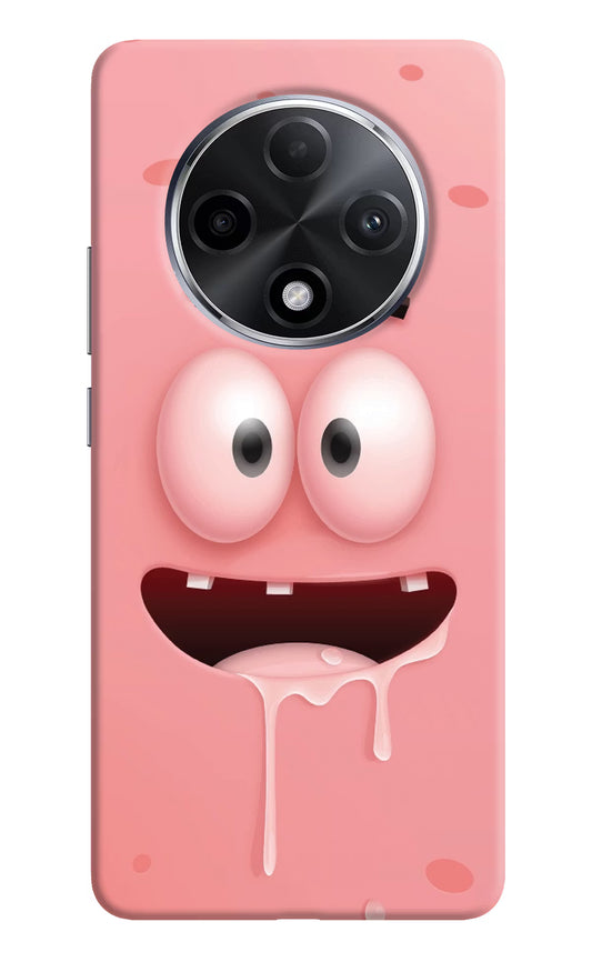 Sponge 2 Oppo F27 Pro Plus Hard Case Back Cover by Casekaro