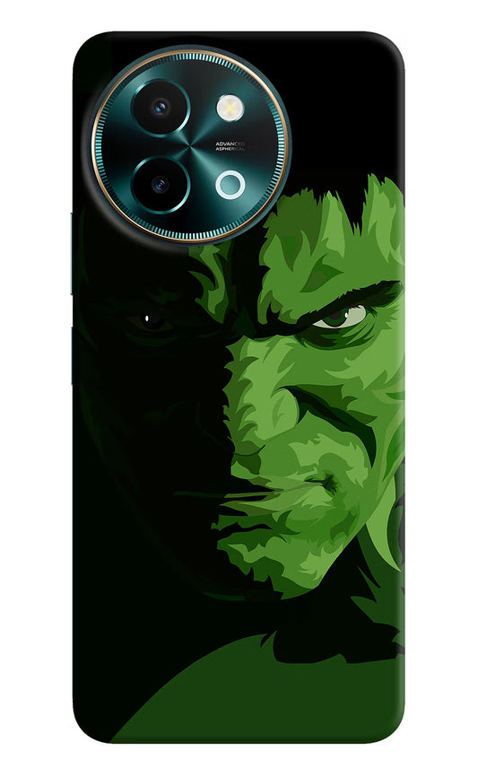 HULK Vivo Y58 5G Hard Case Back Cover by Casekaro