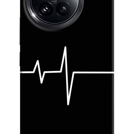 Heart Beats Xiaomi 14 Civi Hard Case Back Cover by Casekaro